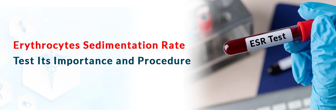  Erythrocytes Sedimentation Rate (ESR) Test Its Importance and Procedure